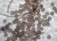 Chaetomium Species globosum spores from air testing cassette