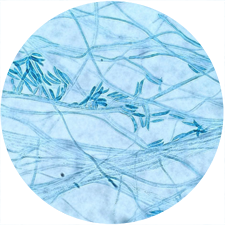 Fusarium-microscopy-cotton-blue