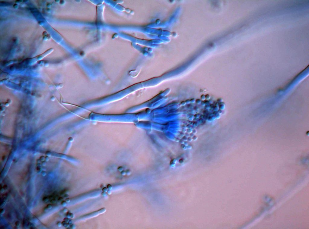 Penicillium brevicompactum microscopy mold analysis mr natural